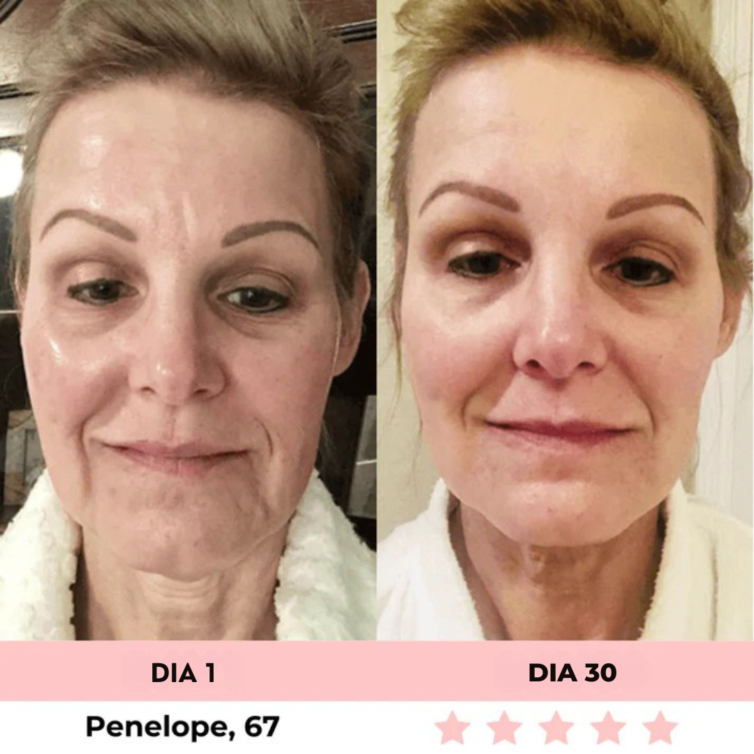 Luméa™ – Escultor Facial LED 3 en 1