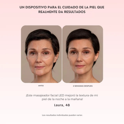 Luméa™ – Escultor Facial LED 3 en 1