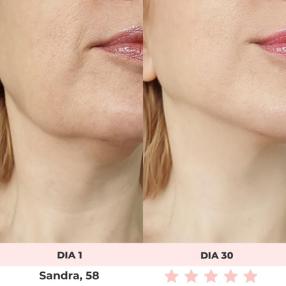 Luméa™ – Escultor Facial LED 3 en 1