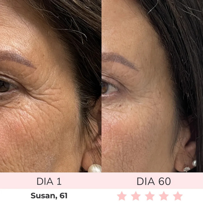 Luméa™ – Escultor Facial LED 3 en 1