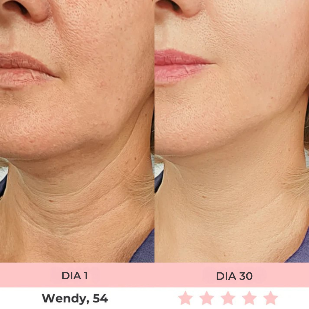 Luméa™ – Escultor Facial LED 3 en 1