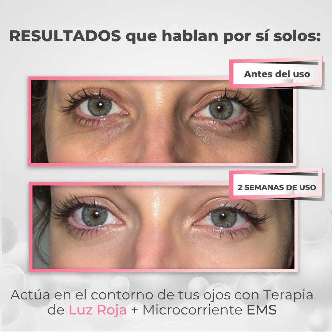 DualLift PRO™ Luz Roja + EMS para Contorno de Ojos (ojeras)