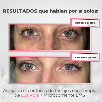 DualLift PRO™ Luz Roja + EMS para Contorno de Ojos (ojeras)