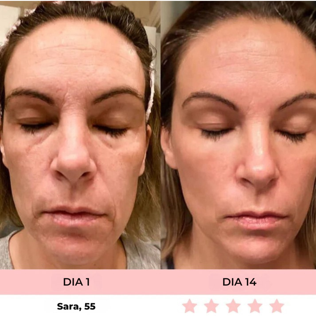 Luméa™ – Escultor Facial LED 3 en 1