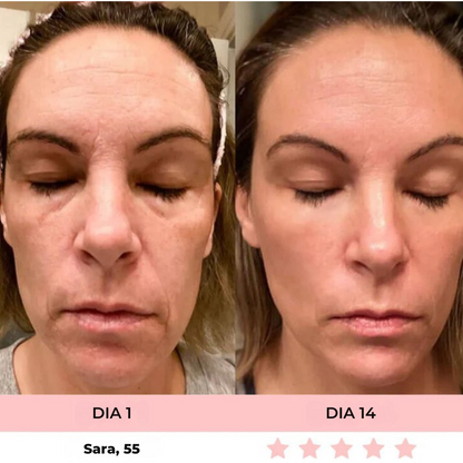 Luméa™ – Escultor Facial LED 3 en 1