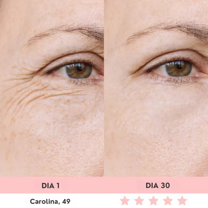 Luméa™ – Escultor Facial LED 3 en 1