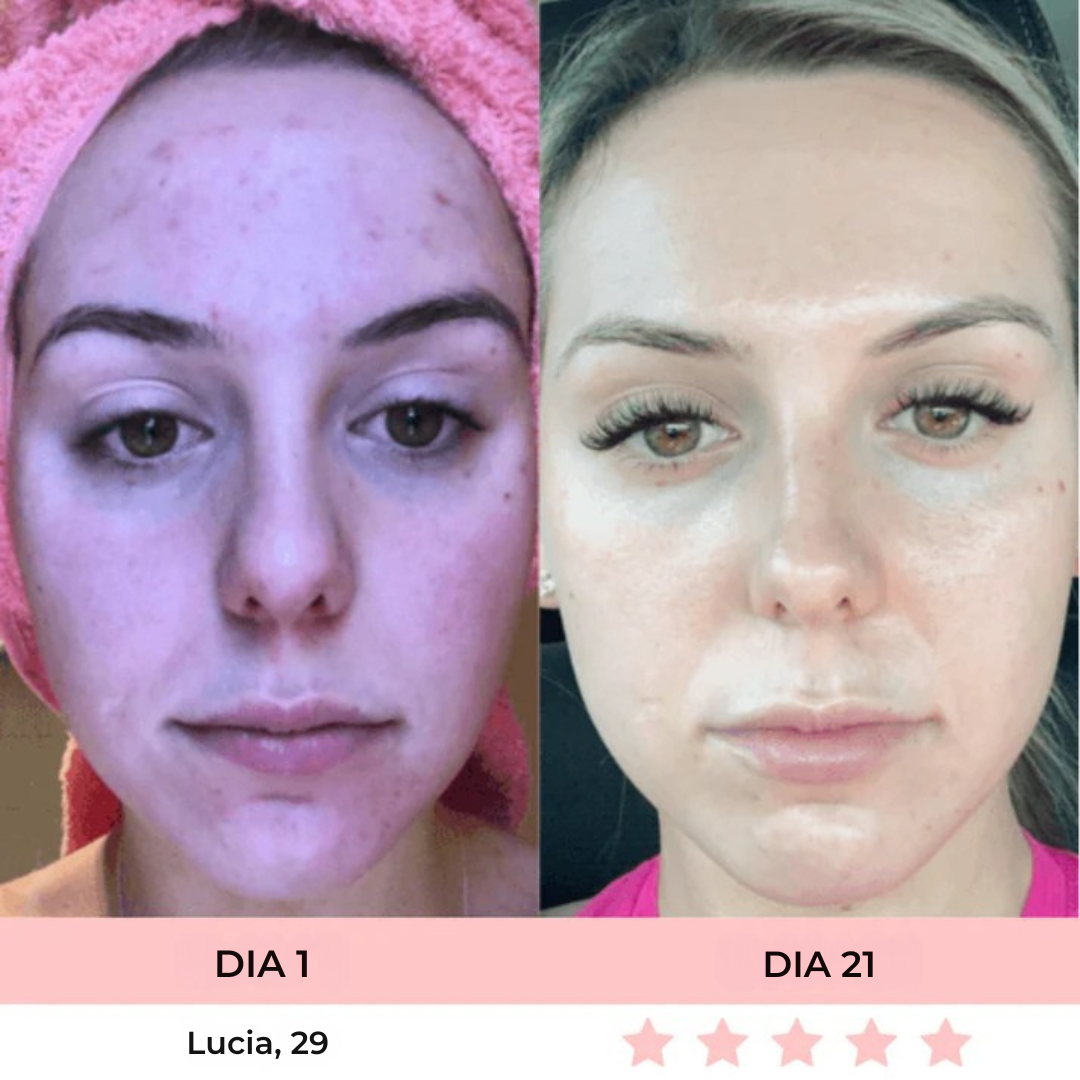 Luméa™ – Escultor Facial LED 3 en 1