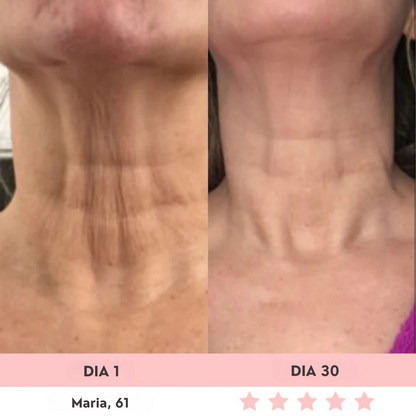 Luméa™ – Escultor Facial LED 3 en 1