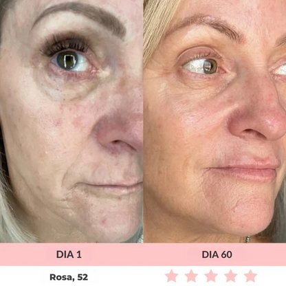 Luméa™ – Escultor Facial LED 3 en 1