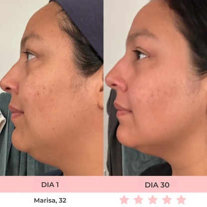 Luméa™ – Escultor Facial LED 3 en 1